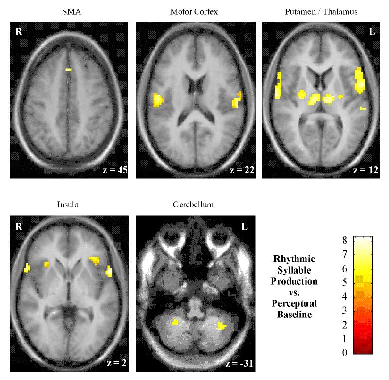 fMRT-Aufnahme, rhythmisches Sprechen